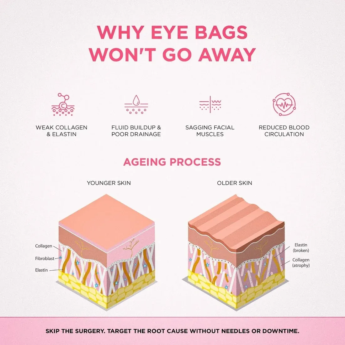 Why eye bags form — collagen, fluid buildup, muscle tone and circulation
